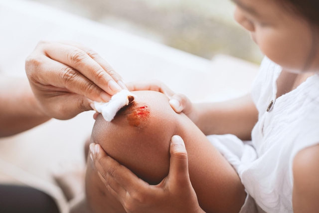 Hướng dẫn chi tiết quy trình rửa vết thương hở nhỏ tại nhà để tránh những biến chứng nguy hiểm- Ảnh 1.