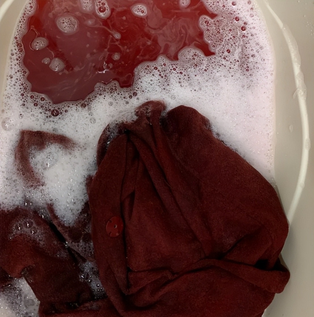 Đừng mua 4 kiểu quần áo này: Dìm dáng thê thảm, kém sang thôi nhé- Ảnh 2.