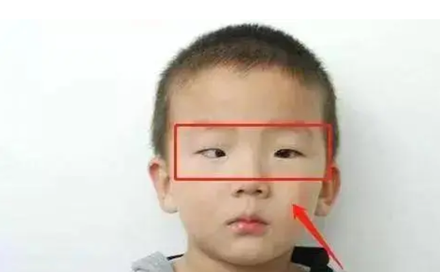 Bé 5 tuổi chơi game trong thời gian dài, tròng đen dần biến mất, bác sĩ cảnh báo rất khó phục hồi
- Ảnh 2.