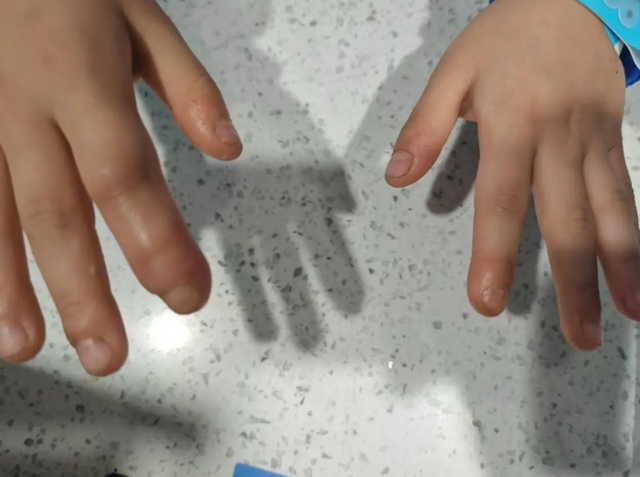 Trẻ hay cắn móng tay? Cẩn thận “cắn” ra vấn đề nghiêm trọng, bố mẹ đừng chủ quan!- Ảnh 1.