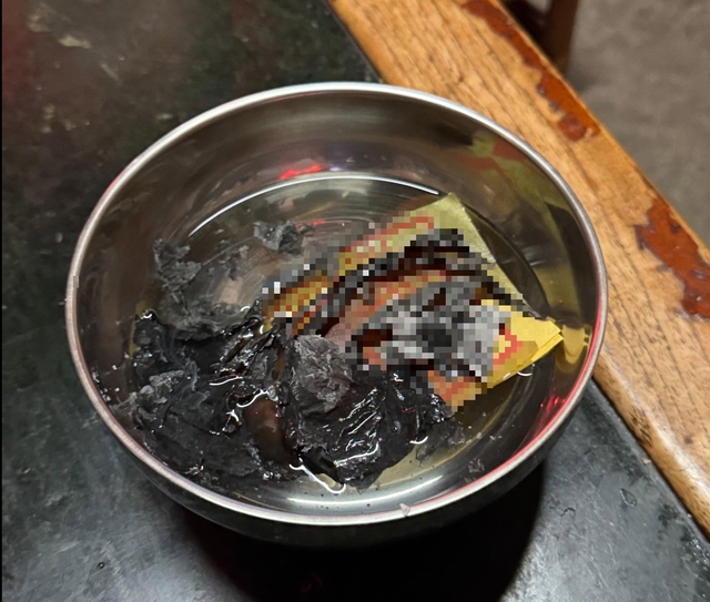 Bé gái 2 tuổi co giật, nôn mửa, thận "chất đầy" chì, suýt chết vì mẹo chữa khó ngủ không xa lạ với người Việt- Ảnh 1.