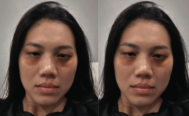 Dụi mắt không nhận ra Ánh Viên, sao lại ra nông nỗi này?- Ảnh 1.