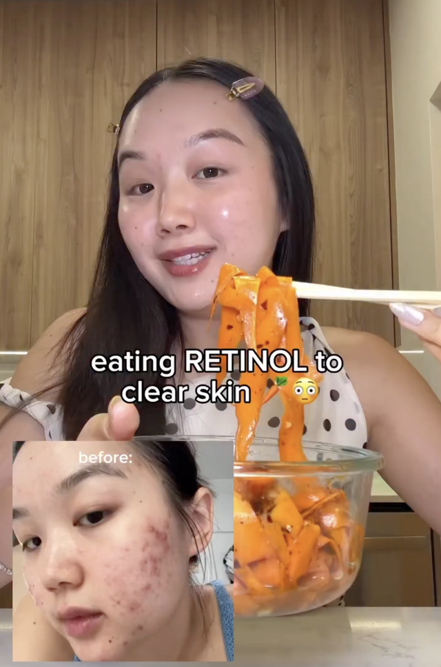 Bát salad 5’ tạo retinol dồi dào, mặt giảm hẳn mụn mà da vẫn lành- Ảnh 1.