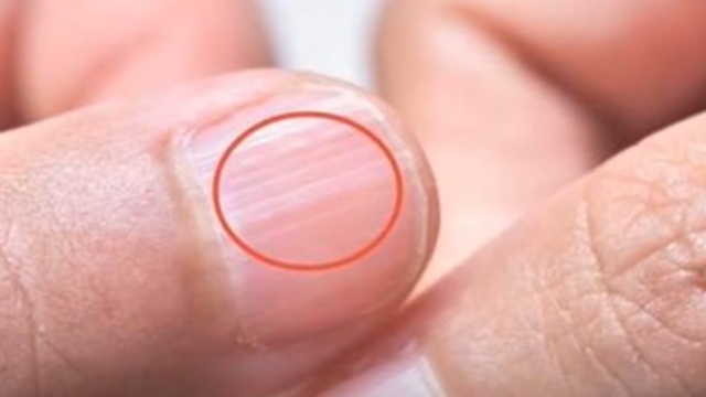 Bàn tay là tín hiệu cảnh báo sức khỏe: 1 thay đổi có thể cho thấy bệnh tiểu đường hoặc xơ gan- Ảnh 3.