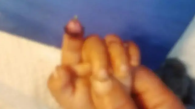 Bé gái 1 tuổi bị thỏ cắn đứt ngón tay khi cho ăn- Ảnh 2.