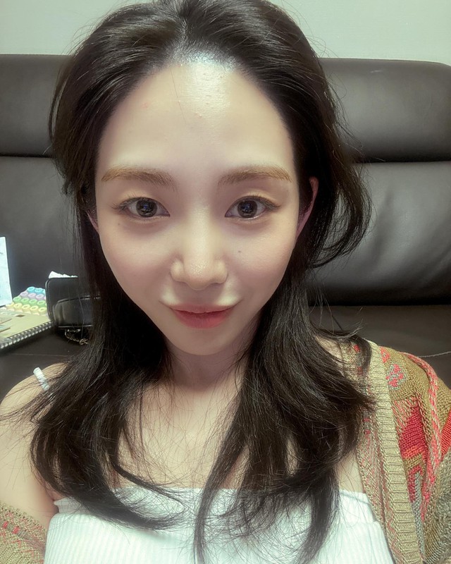 Nữ ca sĩ mất Tết, bị bỏng nặng một bên mặt khi đi làm đẹp- Ảnh 4.