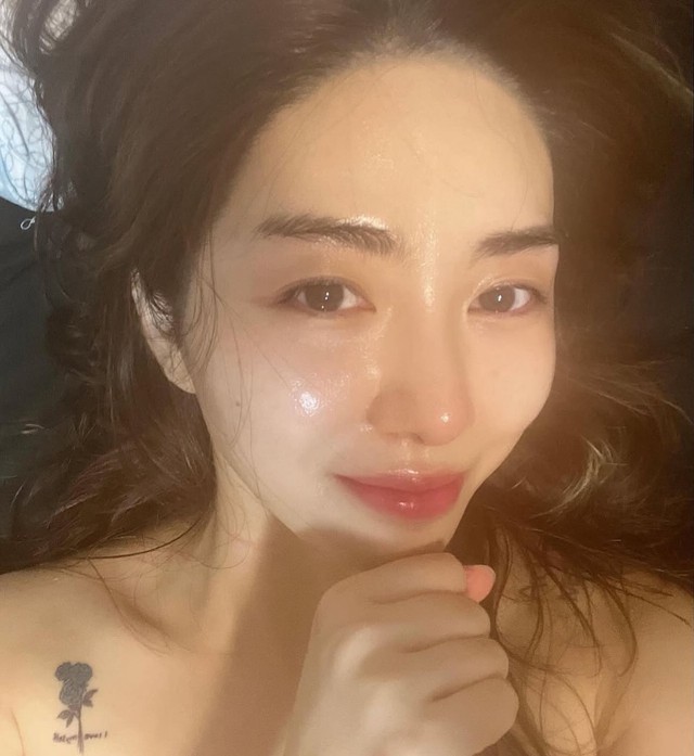 Nữ ca sĩ mất Tết, bị bỏng nặng một bên mặt khi đi làm đẹp- Ảnh 1.