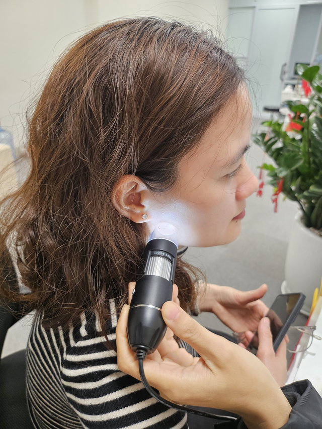 Điều trị mụn ẩn tuổi 36: Khi tôi chọn giải pháp da liễu thay vì tự xử tại nhà- Ảnh 2.