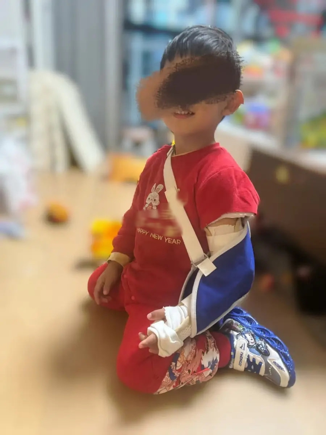 Trung Quốc: Bé 2 tuổi ngã gãy xương ở cơ sở vui chơi trẻ em nổi tiếng, diễn biến sau đó mới đau lòng- Ảnh 2.