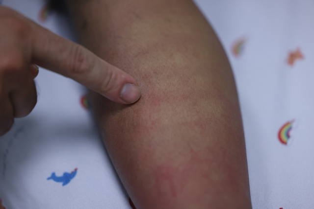 Những "màu đỏ không Tết" do Sốt xuất huyết Dengue và cuộc chiến giành lại mùa xuân - Ảnh 12.