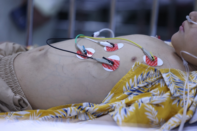 Những "màu đỏ không Tết" do Sốt xuất huyết Dengue và cuộc chiến giành lại mùa xuân - Ảnh 7.