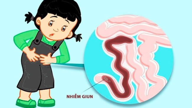 Tẩy giun cho bé và những điều đơn giản nhưng có thể mẹ chưa biết- Ảnh 3. Tẩy giun cho bé và những điều đơn giản nhưng có thể mẹ chưa biết- Ảnh 3.
