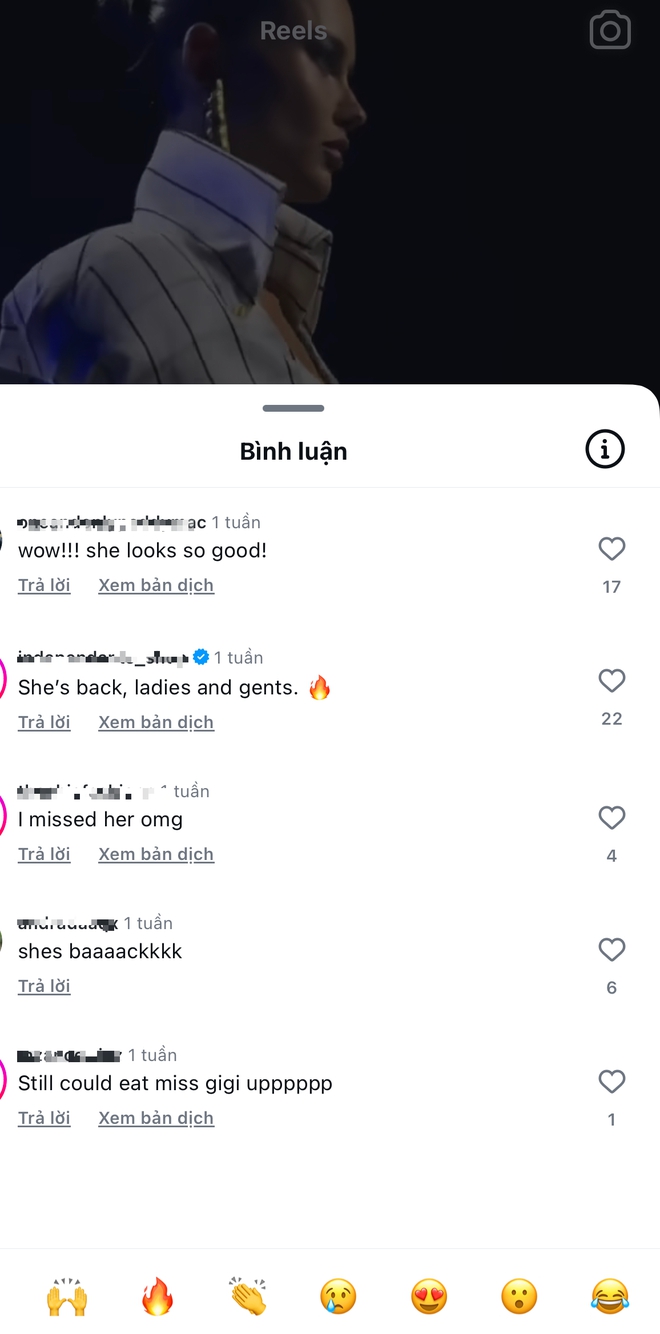 Siêu mẫu Victoria's Secret gây sốc với khuôn mặt biến dạng, từng có ước mơ không ai ngờ- Ảnh 36.