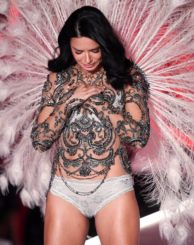 Siêu mẫu Victoria's Secret gây sốc với khuôn mặt biến dạng, từng có ước mơ không ai ngờ- Ảnh 16.
