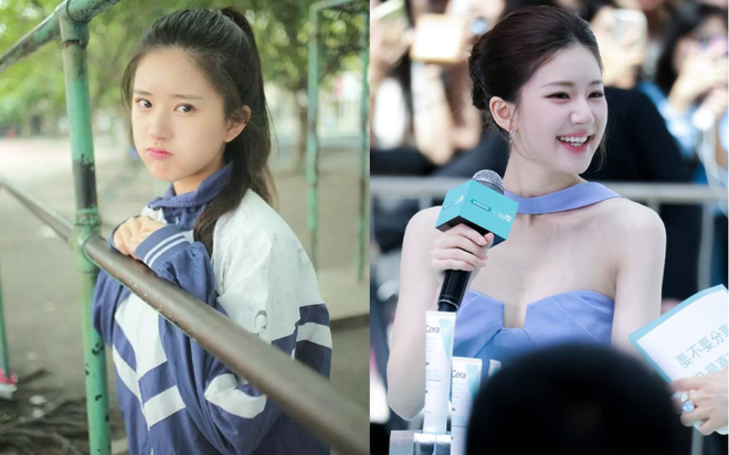 Đây là câu trả lời rõ ràng nhất của Triệu Lộ Tư về tin đồn sửa mũi- Ảnh 17.