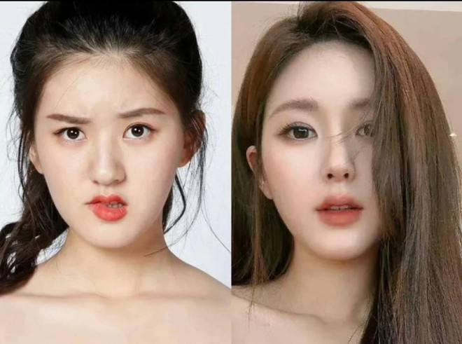 Đây là câu trả lời rõ ràng nhất của Triệu Lộ Tư về tin đồn sửa mũi- Ảnh 1.