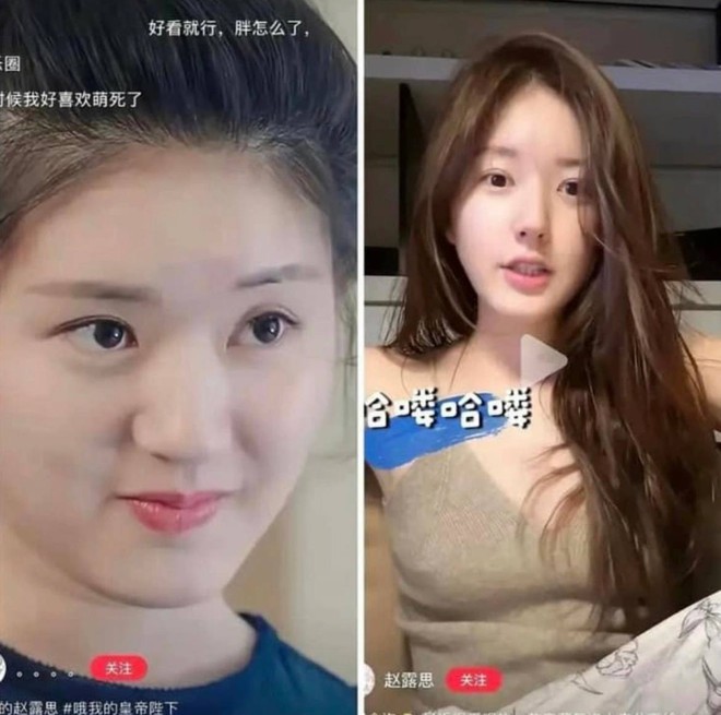 Đây là câu trả lời rõ ràng nhất của Triệu Lộ Tư về tin đồn sửa mũi- Ảnh 2.