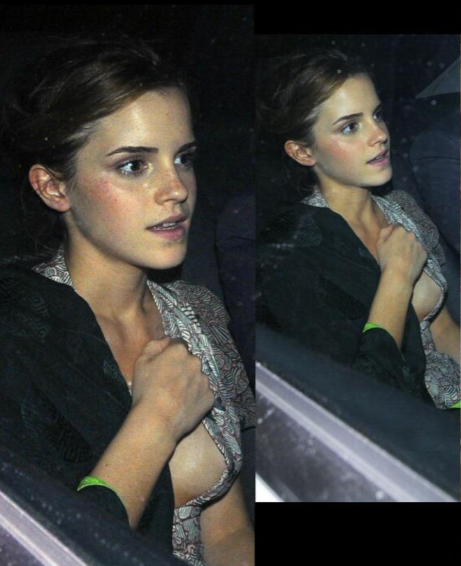 Emma Watson gặp sự cố trang phục nhớ đời với váy xẻ sâu tới rốn - Ảnh 9. Emma Watson gặp sự cố trang phục nhớ đời với váy xẻ sâu tới rốn - Ảnh 9.