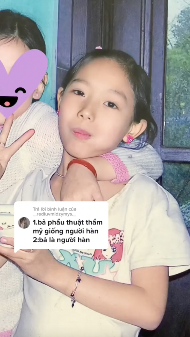 Lộ ảnh thời chưa niềng răng, tiêm filler lên mặt, mỹ nhân Đảo Thiên Đường gây thảng thốt: Khác đến thế sao?- Ảnh 4.