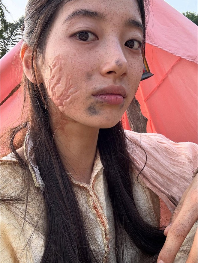 Hình ảnh gây sốc của Suzy trước khi phẫu thuật- Ảnh 3. Hình ảnh gây sốc của Suzy trước khi phẫu thuật- Ảnh 3.