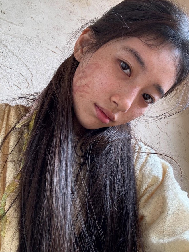 Hình ảnh gây sốc của Suzy trước khi phẫu thuật- Ảnh 2. Hình ảnh gây sốc của Suzy trước khi phẫu thuật- Ảnh 2.