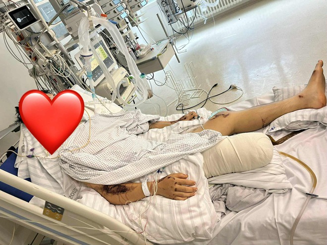 TikToker Bốp có chia sẻ đầu tiên sau tai nạn nghiêm trọng tại Đức, nhắc đến bạn gái với thái độ này- Ảnh 3.