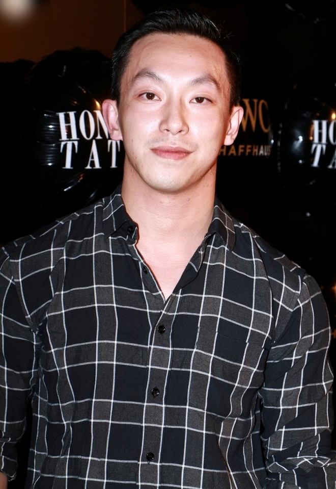 "Hoàng tử showbiz" bị vỡ nát gương mặt, phẫu thuật hơn 10 lần để sửa dung mạo méo mó biến dạng- Ảnh 2.