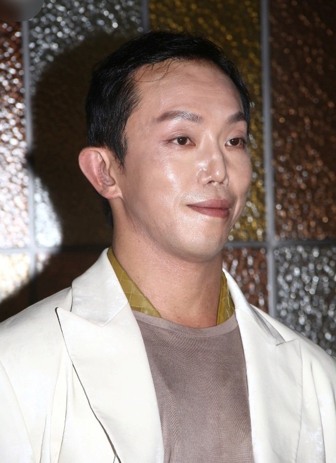 "Hoàng tử showbiz" bị vỡ nát gương mặt, phẫu thuật hơn 10 lần để sửa dung mạo méo mó biến dạng- Ảnh 3.