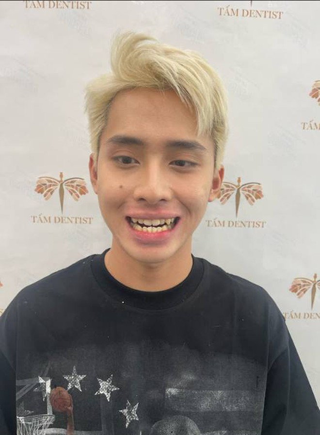 Đau đầu triền miên vi răng chen chúc: Hành trình lấy lại sự tự tin của chàng trai Tiktoker- Ảnh 2.