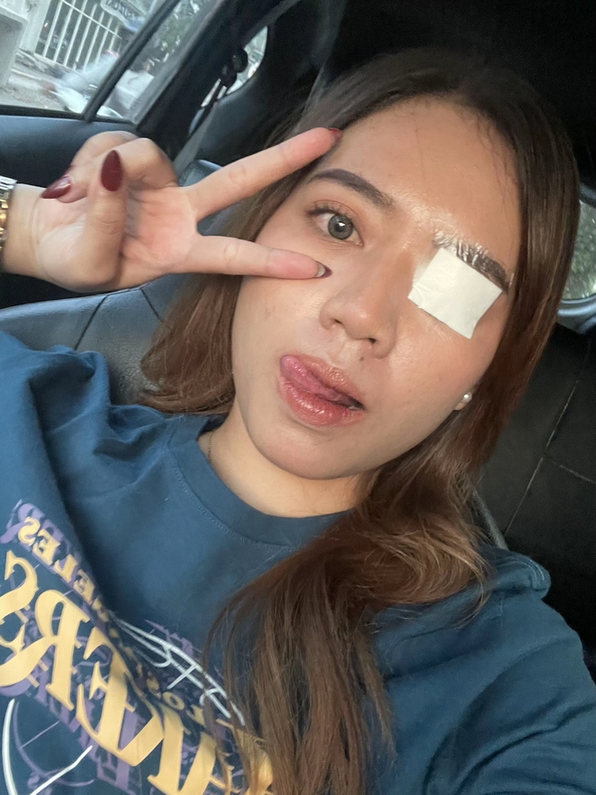 Phấn mắt PINKFLASH dính bê bối lớn: Người dùng bị lẹo mắt hàng loạt, hãng tiêu huỷ, đền tiền gấp đôi- Ảnh 1.