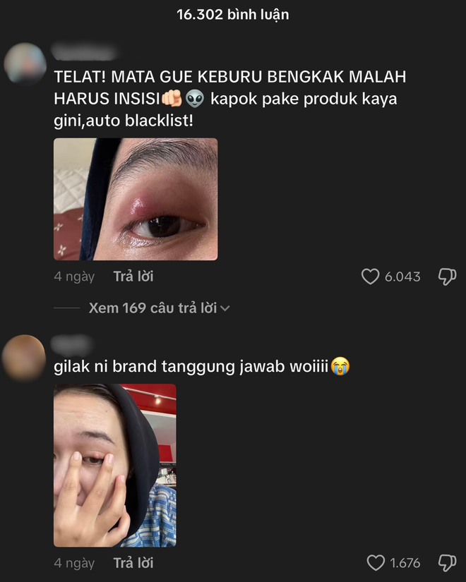 Phấn mắt PINKFLASH dính bê bối lớn: Người dùng bị lẹo mắt hàng loạt, hãng tiêu huỷ, đền tiền gấp đôi- Ảnh 10.