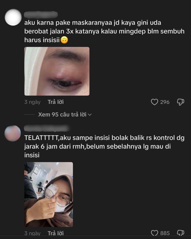 Phấn mắt PINKFLASH dính bê bối lớn: Người dùng bị lẹo mắt hàng loạt, hãng tiêu huỷ, đền tiền gấp đôi- Ảnh 12.