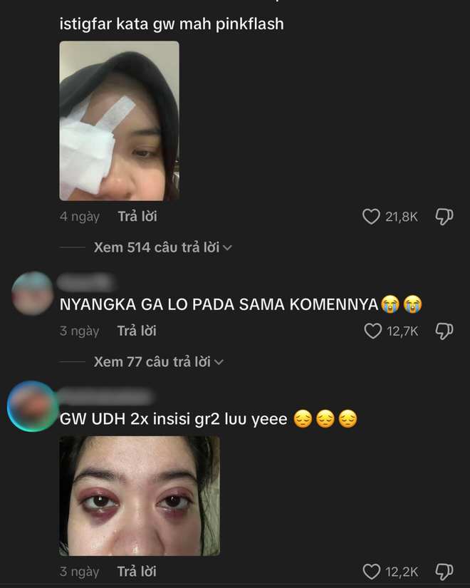 Phấn mắt PINKFLASH dính bê bối lớn: Người dùng bị lẹo mắt hàng loạt, hãng tiêu huỷ, đền tiền gấp đôi- Ảnh 13.