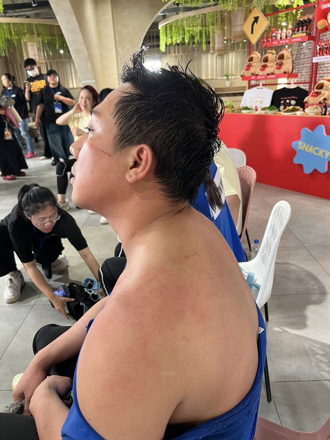 Chưa bao giờ thấy Trấn Thành tơi tả đến mức độ này- Ảnh 9. Chưa bao giờ thấy Trấn Thành tơi tả đến mức độ này- Ảnh 9.