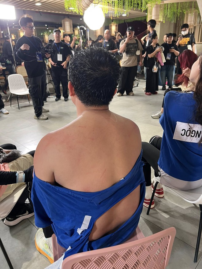 Chưa bao giờ thấy Trấn Thành tơi tả đến mức độ này- Ảnh 6. Chưa bao giờ thấy Trấn Thành tơi tả đến mức độ này- Ảnh 6.