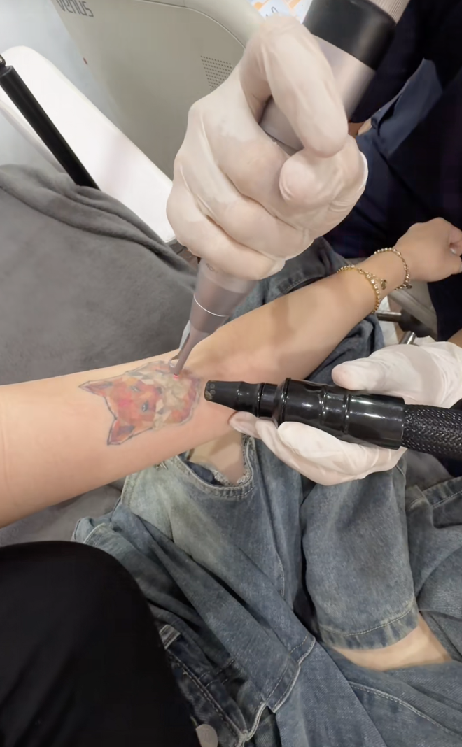 Quyên Qui "mỹ nhân đóng cảnh 18+" tìm cách xóa hình xăm- Ảnh 6.