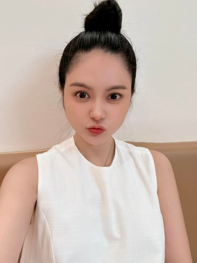 Cô gái khổ sở 30 năm vì tai giống Đoàn Di Băng- Ảnh 7.