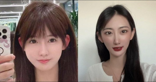 Cô gái khổ sở 30 năm vì tai giống Đoàn Di Băng- Ảnh 4.