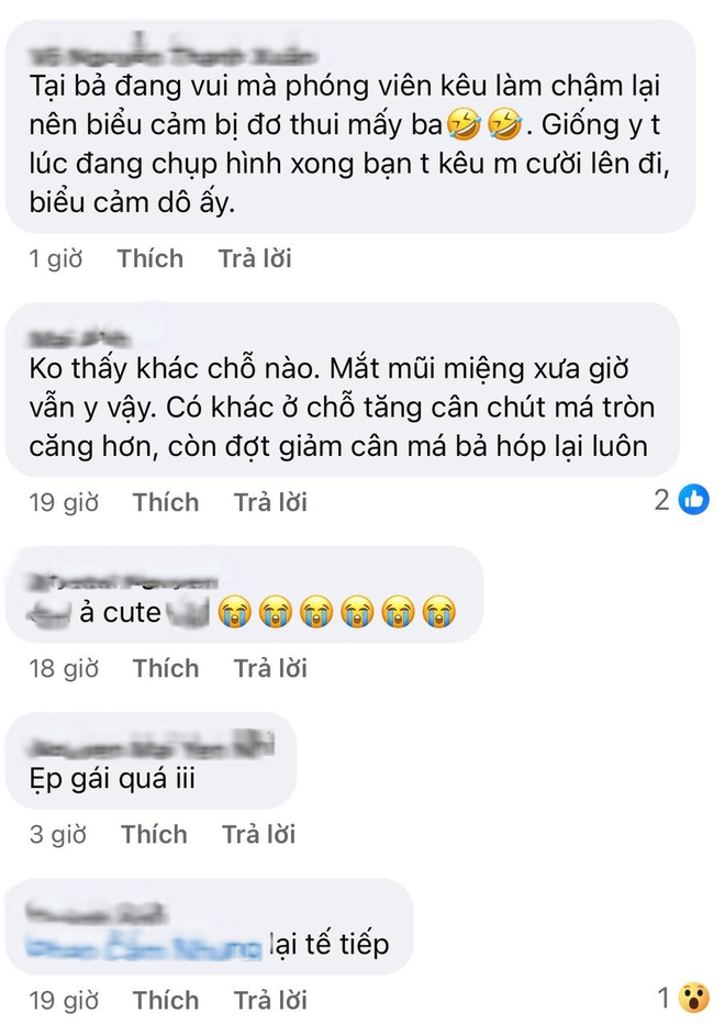 Cũng tới ngày Kim Ji Won bị soi quá đà: Mặt vậy mà vẫn chê?- Ảnh 3.