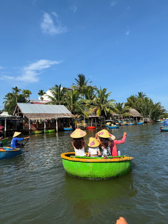 Mỹ nhân phim giờ vàng liều lĩnh "dao kéo" thu ngắn nhân trung, giờ gánh di chứng đến suốt đời- Ảnh 5. Mỹ nhân phim giờ vàng liều lĩnh "dao kéo" thu ngắn nhân trung, giờ gánh di chứng đến suốt đời- Ảnh 5.