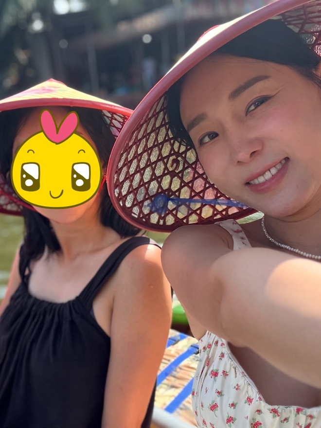 Mỹ nhân phim giờ vàng liều lĩnh "dao kéo" thu ngắn nhân trung, giờ gánh di chứng đến suốt đời- Ảnh 4. Mỹ nhân phim giờ vàng liều lĩnh "dao kéo" thu ngắn nhân trung, giờ gánh di chứng đến suốt đời- Ảnh 4.