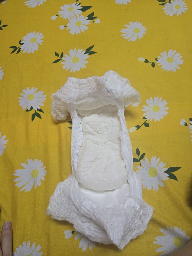 Check tã quần Bobby Antimos: Xoa dịu nỗi bất an của mẹ bỉm có con không đáp ứng thuốc hạ sốt Paracetamol- Ảnh 14.