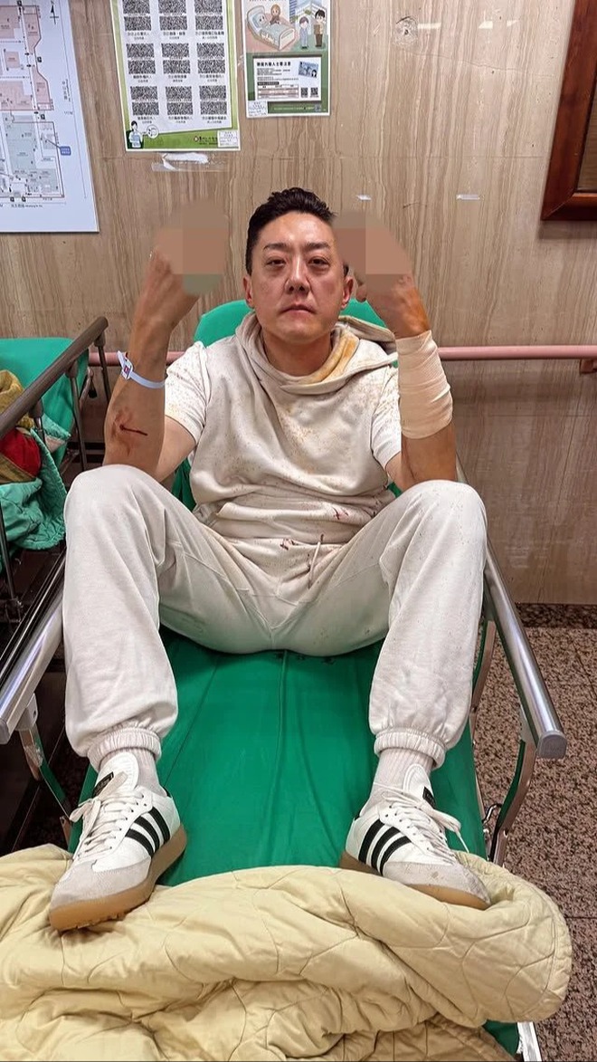 Kinh hoàng: "Ông trùm hộp đêm showbiz" bị hai kẻ lạ mặt xịt hơi cay, đuổi chém đến thương tích trong bãi đỗ xe- Ảnh 2.