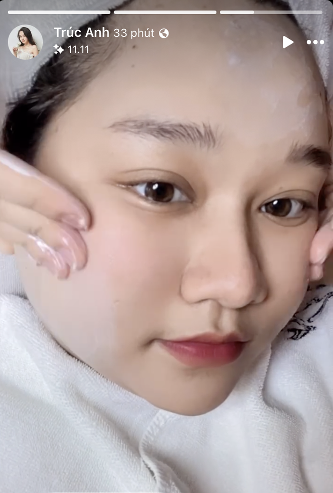 Trúc Anh (Mắt Biếc) visual từng như "nàng thơ" nay nhận không ra: Nguyên nhân xuất phát từ 1 căn bệnh- Ảnh 10.
