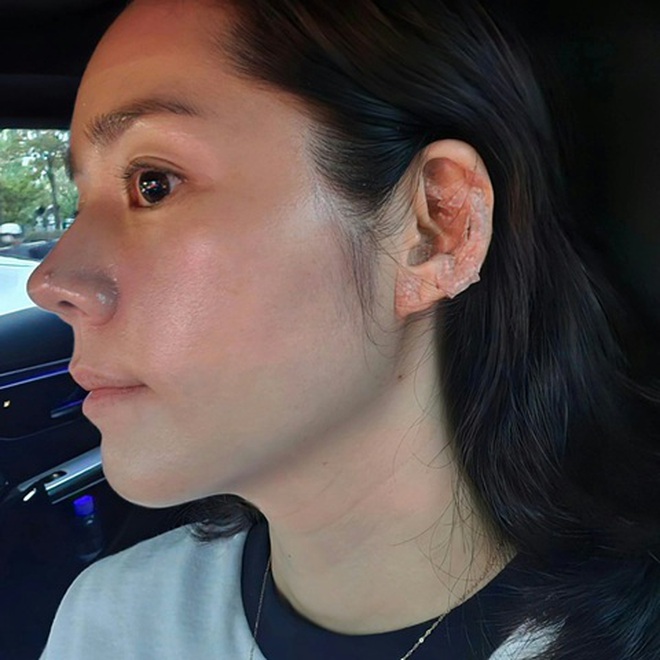 Người có chiếc mũi đẹp nhất Hàn Quốc nói không với 3 món, muốn trẻ lâu bạn nên né- Ảnh 3. Người có chiếc mũi đẹp nhất Hàn Quốc nói không với 3 món, muốn trẻ lâu bạn nên né- Ảnh 3.