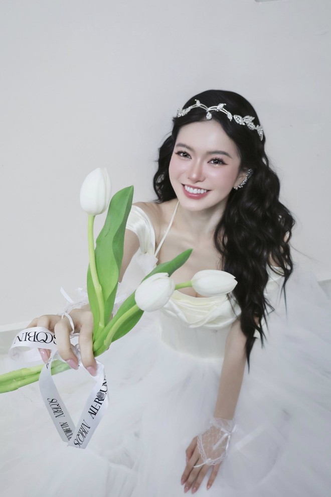 Yên Đan - “công chúa của SOOBIN”: Ngỡ ngàng diện mạo trước khi phẫu thuật - Ảnh 2.