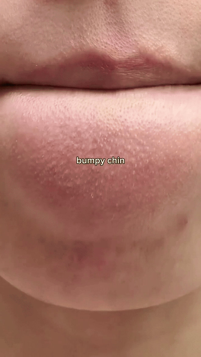 Đắp thứ như rêu lên mặt, cô gái hút 14 triệu lượt vào hóng kết quả- Ảnh 8.