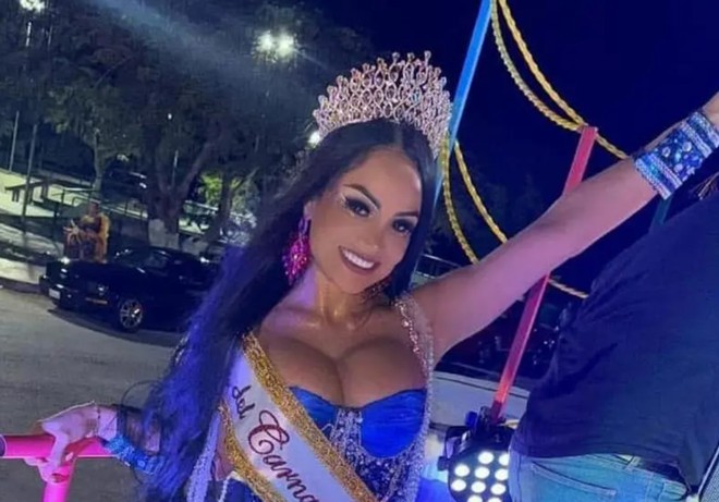Nữ hoàng thể hình được phát hiện đã chết trong hồ bơi khách sạn, cảnh sát mở cuộc điều tra- Ảnh 3.