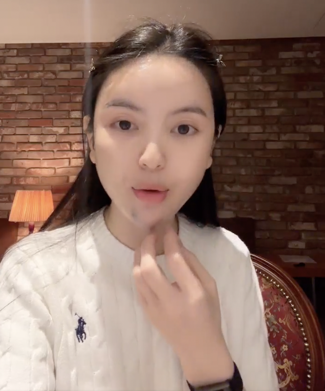 Chu Thanh Huyền kể lại trải nghiệm kinh hoàng khi đi xử lý hậu quả phẫu thuật thẩm mỹ- Ảnh 1.