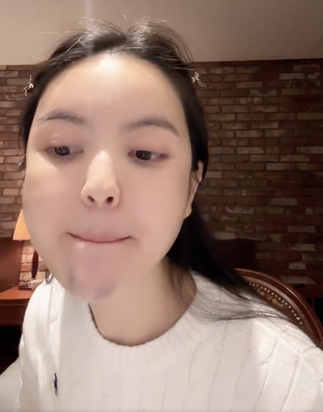 Chu Thanh Huyền kể lại trải nghiệm kinh hoàng khi đi xử lý hậu quả phẫu thuật thẩm mỹ- Ảnh 4.